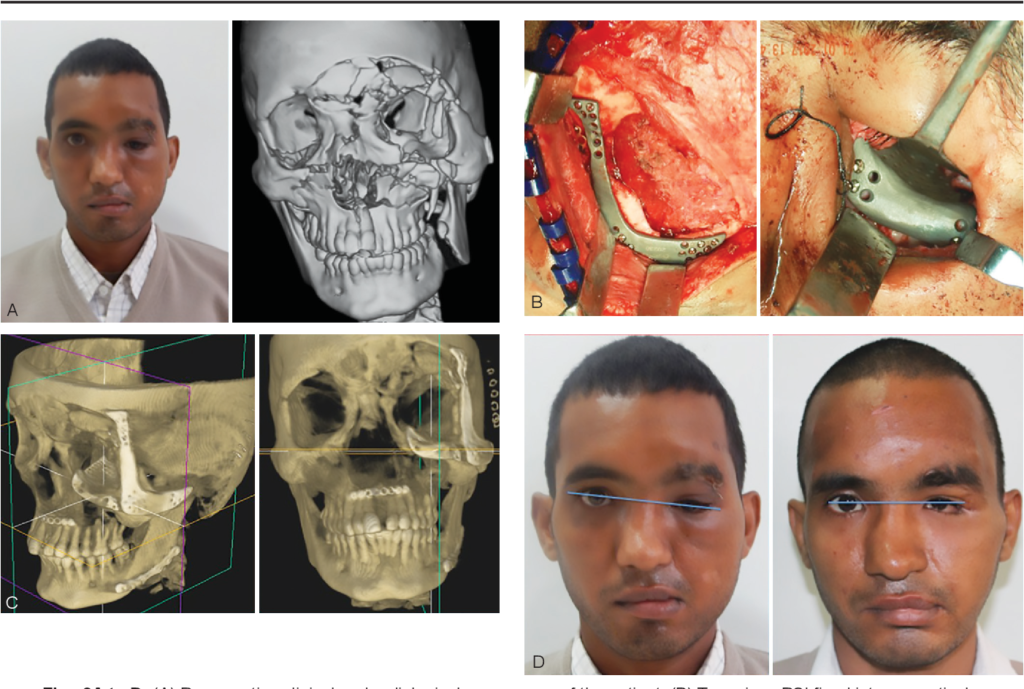 Dental & maxillofacial reconstructive services in Multan